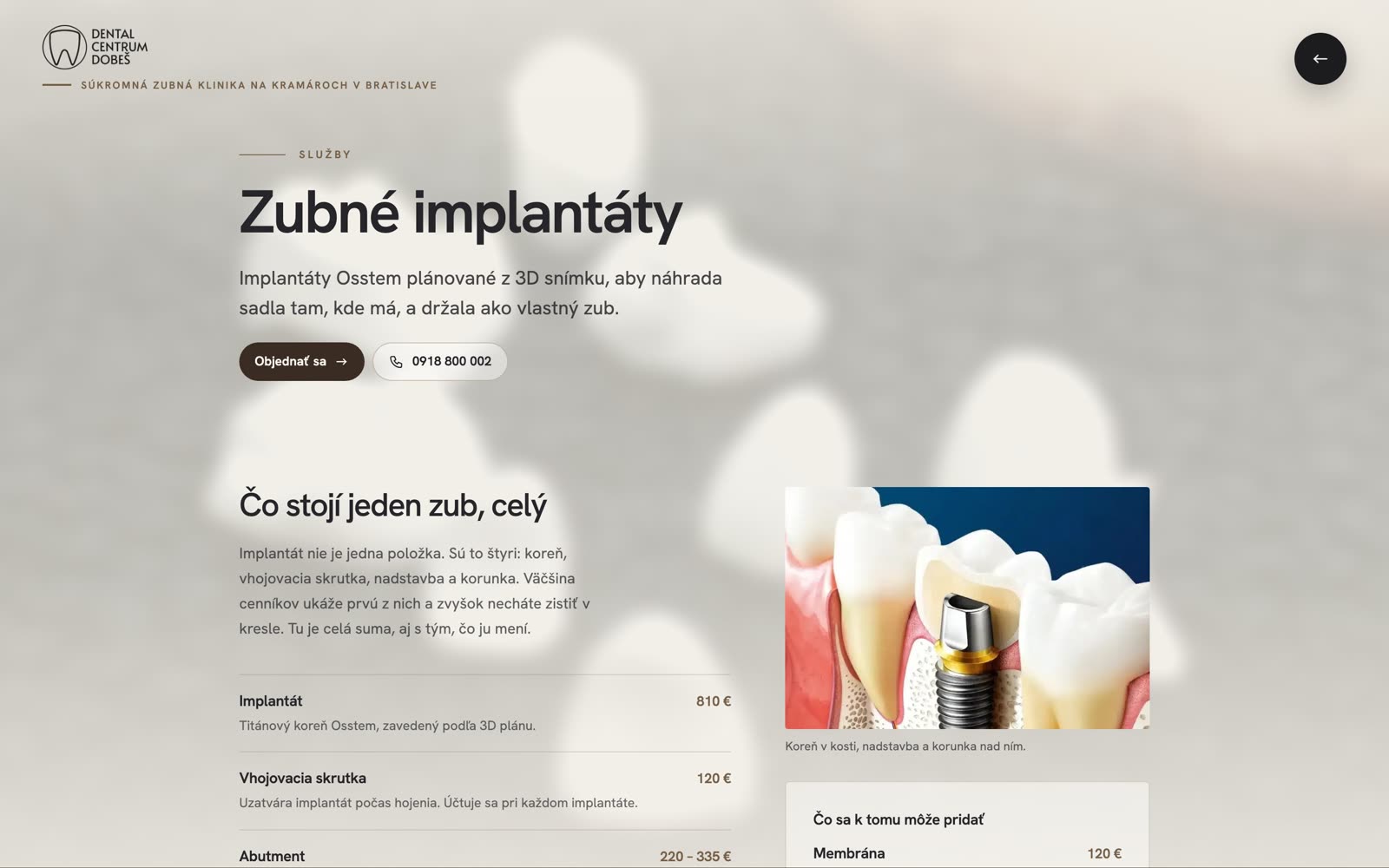 Stránka služby Zubné implantáty s celou cenou zuba