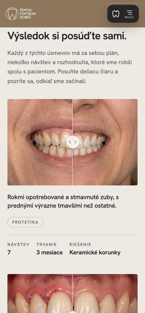 Pacienti pred a po na mobile