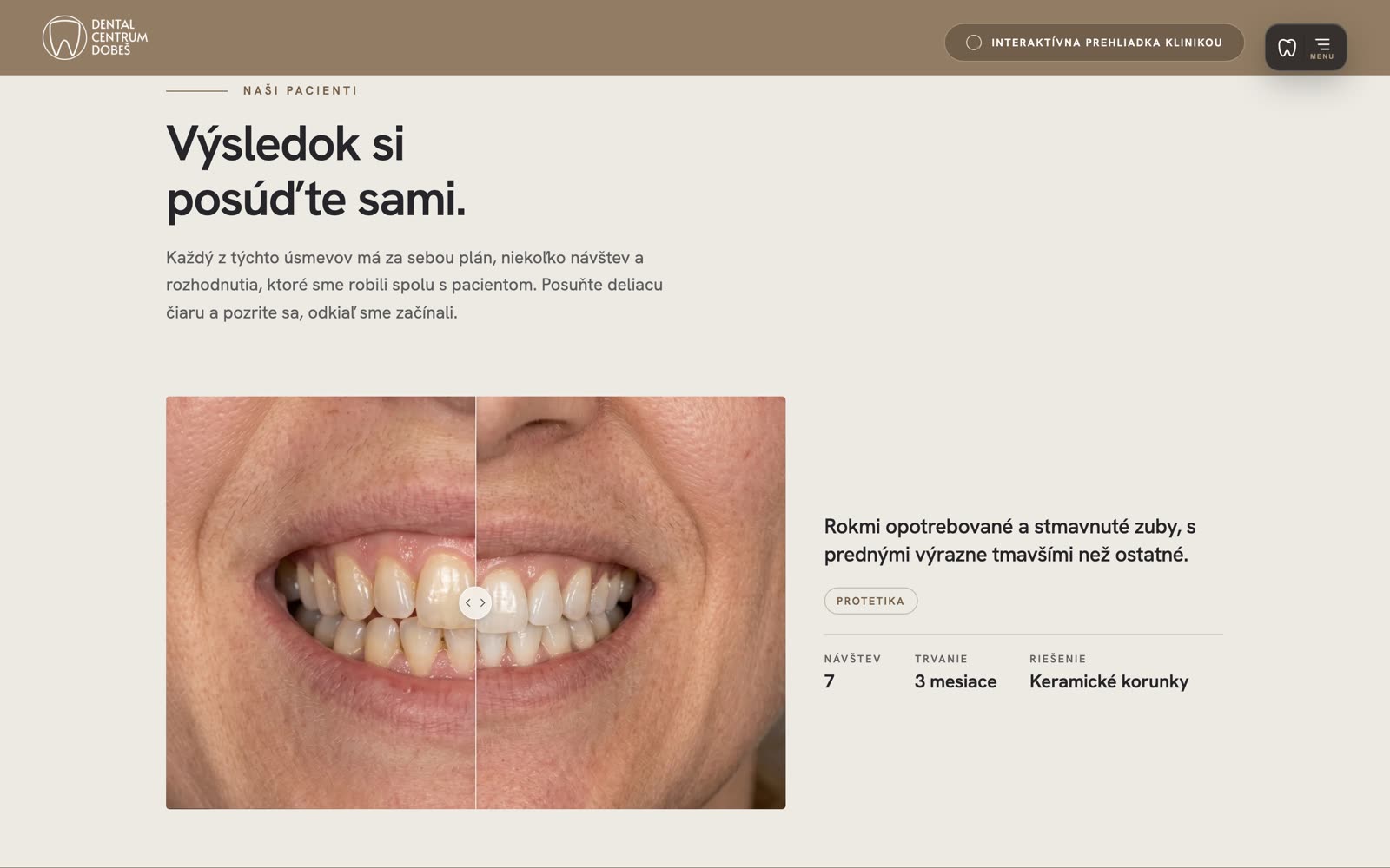 Porovnanie pred a po s posuvníkom